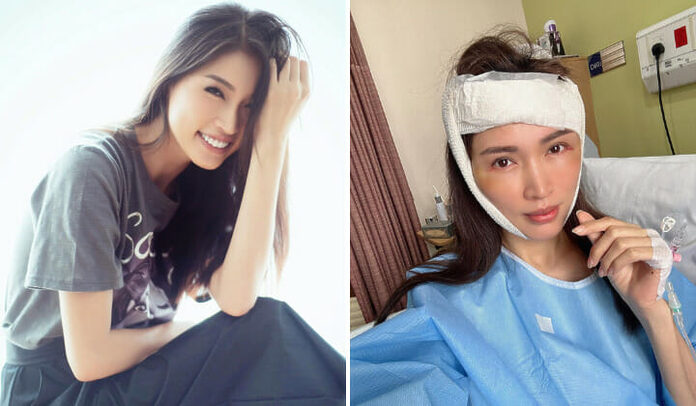 Amber Chia Suffers Brain Bleed After Blacking Out And Falling From Stairs