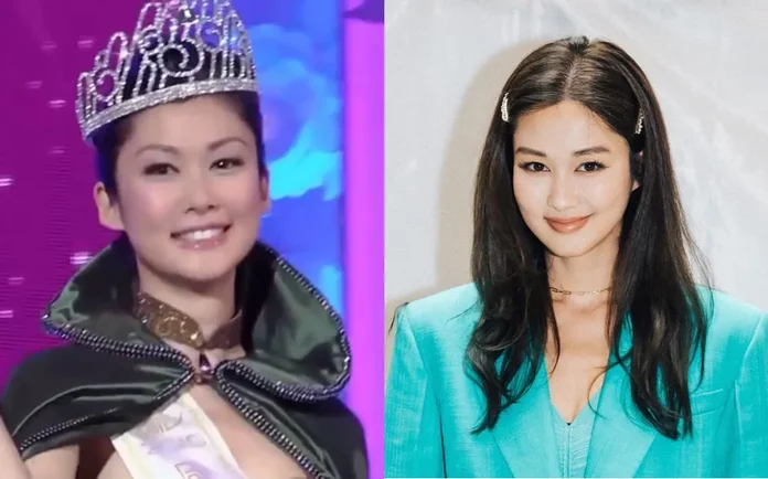 HK Actress Eliza Sam Enhanced Her Eyes With Plastic Surgery?