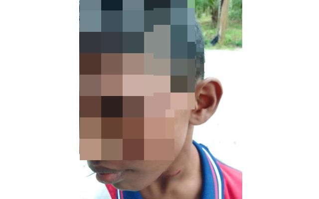 Tamil school pupil in Johor claims injured after caning by principal