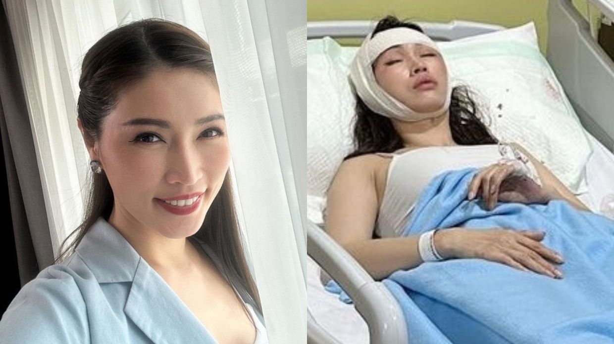 Amber Chia’s Blackout and Stair Fall Lead to Brain Bleed