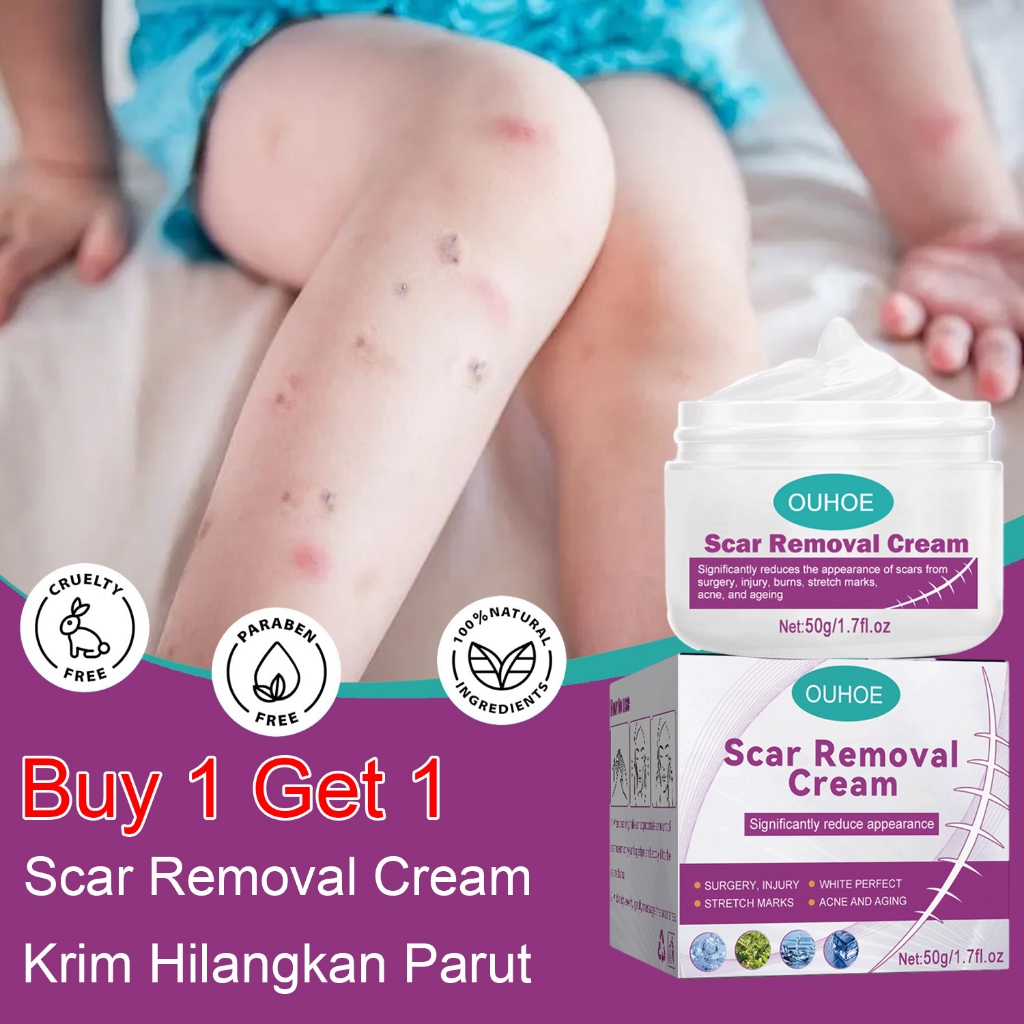 Scar Removal Cream Repair Old Scars Repair Ubat Krim Hilangkan Parut Scald Scar Krim Hilangkan Parut Hitam祛疤膏旧伤疤修复膏