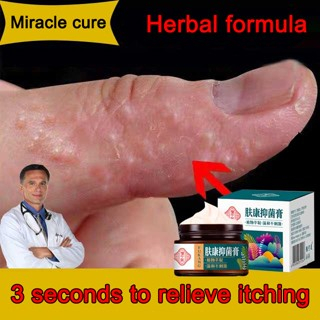 Ubat gatal herba cina-krim gatal kulit-Psoriasis cream-Eczema cream 30g 止痒膏 Suitable for men/women/elderly/children